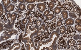 Anti-Derlin-1 Antibody, clone 2C2, ZooMAb® Rabbit Monoclonal recombinant, expressed in HEK 293 cells