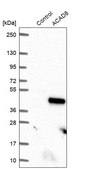 Anti-ACAD8 antibody produced in rabbit Prestige Antibodies® Powered by Atlas Antibodies, affinity isolated antibody, buffered aqueous glycerol solution