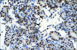 Anti-GTF2I antibody produced in rabbit affinity isolated antibody