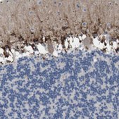 Anti-MARCH8 antibody produced in rabbit Prestige Antibodies® Powered by Atlas Antibodies, affinity isolated antibody, buffered aqueous glycerol solution