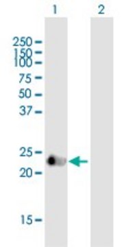 Anti-VASH1 antibody produced in mouse purified immunoglobulin, buffered aqueous solution