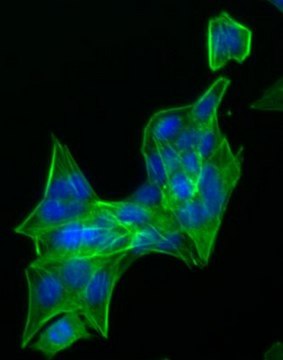 N27-A Rat Dopaminergic Neural Cell Line N27-A rat dopaminergic neural cell line is a suitable model for Parkinson&#8217;s disease research.