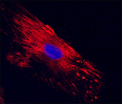 Anti-Cellular Fibronectin antibody, Mouse monoclonal clone FN-3E2, hybridoma cell culture supernatant