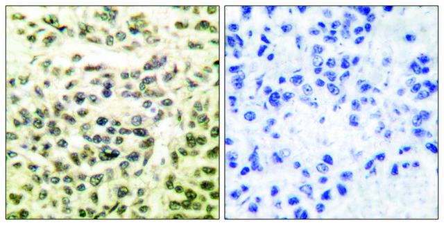 Anti-GSK3 antibody produced in rabbit affinity isolated antibody