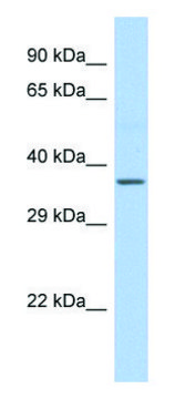 Anti-CYTB (C-terminal) antibody produced in rabbit affinity isolated antibody