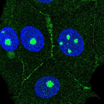 抗AGER 兔抗 Prestige Antibodies&#174; Powered by Atlas Antibodies, affinity isolated antibody