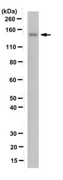 Anti-FANCJ/BACH1 Antibody, clone 2G7 clone 2G7, from mouse