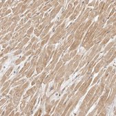 Anti-ARHGEF10L antibody produced in rabbit Prestige Antibodies® Powered by Atlas Antibodies, affinity isolated antibody, buffered aqueous glycerol solution, ab2