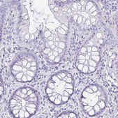 Anti-PLAC1 antibody produced in rabbit Prestige Antibodies® Powered by Atlas Antibodies, affinity isolated antibody, buffered aqueous glycerol solution