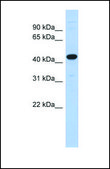 Anti-UBA3, (N-terminal) antibody produced in rabbit affinity isolated antibody