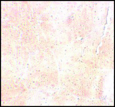 Anti-SYNPO2 antibody produced in rabbit affinity isolated antibody, buffered aqueous solution