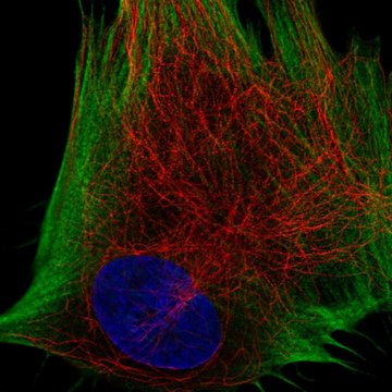 Anti-DDR2 antibody produced in rabbit Prestige Antibodies&#174; Powered by Atlas Antibodies, affinity isolated antibody