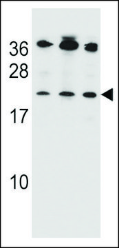 ANTI-BAK (BH3 DOMAIN SPECIFIC) antibody produced in rabbit IgG fraction of antiserum, buffered aqueous solution