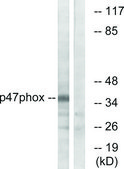 Anti-p47 PHOX antibody produced in rabbit affinity isolated antibody