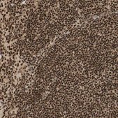 Anti-RNF113A antibody produced in rabbit Prestige Antibodies® Powered by Atlas Antibodies, affinity isolated antibody, buffered aqueous glycerol solution