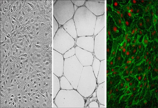 Human Dermal Microvascular Endothelial Cells: CADMEC/HMVEC, neonatal