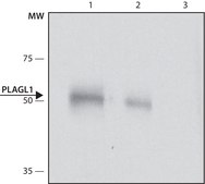 Anti-PLAGL1 (C-terminal) antibody produced in rabbit ~1.0 mg/mL, affinity isolated antibody, buffered aqueous solution