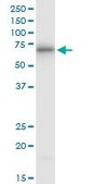 Monoclonal Anti-ATE1 antibody produced in mouse clone 2B6, purified immunoglobulin, buffered aqueous solution