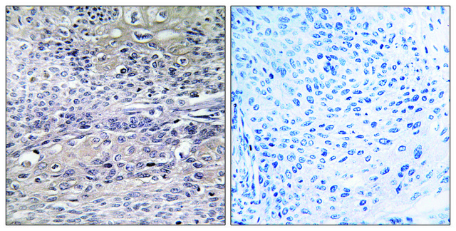 Anti-IREB1 antibody produced in rabbit affinity isolated antibody