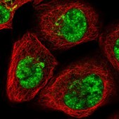 Anti-SART1 antibody produced in rabbit Prestige Antibodies® Powered by Atlas Antibodies, affinity isolated antibody, buffered aqueous glycerol solution, ab2