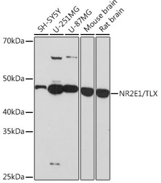 Anti-NR2E1/TLX Antibody, clone 6P3H8, Rabbit Monoclonal