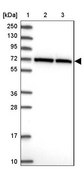 Anti-CCDC112 antibody produced in rabbit Prestige Antibodies® Powered by Atlas Antibodies, affinity isolated antibody, buffered aqueous glycerol solution