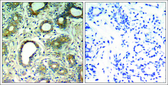 Anti- pTyr580 antibody produced in rabbit affinity isolated antibody