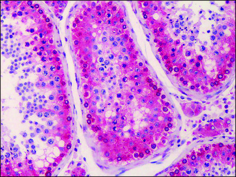 Anti-NANOS3 antibody produced in rabbit affinity isolated antibody