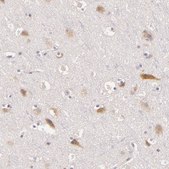 Anti-C14orf37 antibody produced in rabbit Prestige Antibodies&#174; Powered by Atlas Antibodies, affinity isolated antibody, buffered aqueous glycerol solution