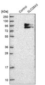 Anti-SLC28A3 antibody produced in rabbit Prestige Antibodies® Powered by Atlas Antibodies, affinity isolated antibody, buffered aqueous glycerol solution, Ab2