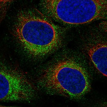 Anti-Tex264 Antibody Produced In Rabbit Prestige Antibodies&#174; Powered by Atlas Antibodies, affinity isolated antibody, buffered aqueous glycerol solution