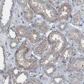 Anti-ATP2B1 antibody produced in rabbit Prestige Antibodies® Powered by Atlas Antibodies, affinity isolated antibody, buffered aqueous glycerol solution
