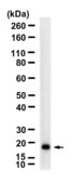 Anti-TIMP3 Antibody, clone 1H8 ZooMAb® Rabbit Monoclonal recombinant, expressed in HEK 293 cells