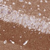 Anti-DPP6 antibody produced in rabbit Prestige Antibodies® Powered by Atlas Antibodies, affinity isolated antibody, buffered aqueous glycerol solution