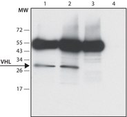 Anti-VHL antibody produced in rabbit ~1.0 mg/mL, affinity isolated antibody