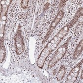 Anti-HNRNPU antibody produced in rabbit Prestige Antibodies&#174; Powered by Atlas Antibodies, affinity isolated antibody, buffered aqueous glycerol solution