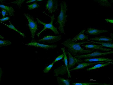 Anti-RARSL antibody produced in mouse purified immunoglobulin, buffered aqueous solution