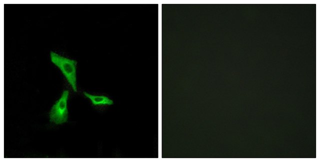 Anti-GPR101 antibody produced in rabbit affinity isolated antibody