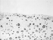 抗-淀粉样蛋白抗体，β 1-16，克隆DE2 culture supernatant, clone DE2, Chemicon®