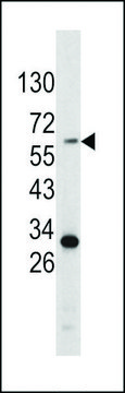 ANTI-TYROSINASE(C-TERMINAL) antibody produced in rabbit purified immunoglobulin, buffered aqueous solution