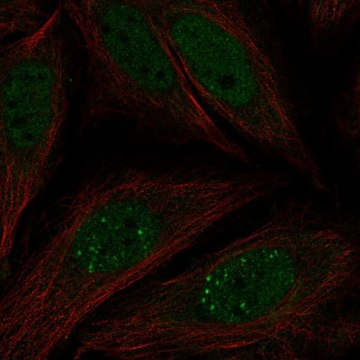 Anti-MKNK2 antibody produced in rabbit Prestige Antibodies&#174; Powered by Atlas Antibodies, affinity isolated antibody