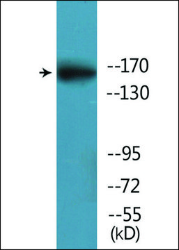 Anti-phospho-FANCD2 (pSer222) antibody produced in rabbit affinity isolated antibody