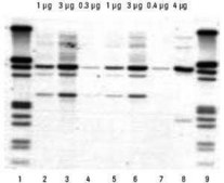 高纯PCR模板制备试剂盒 pkg of 100 purifications, suitable for DNA extraction
