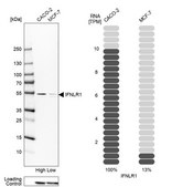 Anti-IFNLR1 antibody produced in rabbit Prestige Antibodies® Powered by Atlas Antibodies, affinity isolated antibody, buffered aqueous glycerol solution