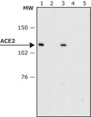 Anti-ACE2 antibody produced in rabbit affinity isolated antibody, buffered aqueous solution