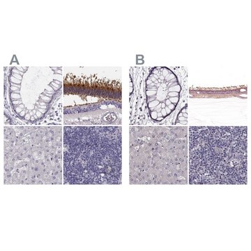 Anti-GRK1 antibody produced in rabbit Prestige Antibodies&#174; Powered by Atlas Antibodies, affinity isolated antibody