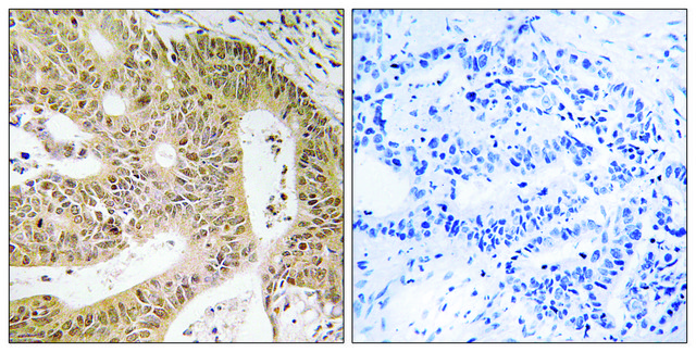 Anti-DAP antibody produced in rabbit affinity isolated antibody