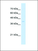 Anti-ARRB2 antibody produced in rabbit affinity isolated antibody