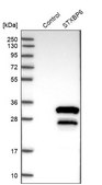 Anti-STXBP6 antibody produced in rabbit Prestige Antibodies® Powered by Atlas Antibodies, affinity isolated antibody, buffered aqueous glycerol solution
