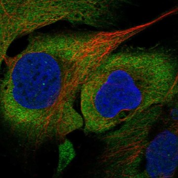 Anti-Eif5A Antibody Produced In Rabbit Prestige Antibodies&#174; Powered by Atlas Antibodies, affinity isolated antibody, buffered aqueous glycerol solution